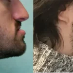Casos clínicos ORTHOFACIAL