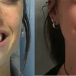 Casos clínicos ORTHOFACIAL