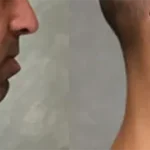 Casos clínicos ORTHOFACIAL