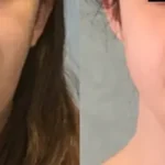 Casos clínicos ORTHOFACIAL