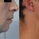 Casos clínicos ORTHOFACIAL