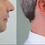Casos clínicos ORTHOFACIAL