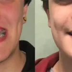 Casos clínicos ORTHOFACIAL