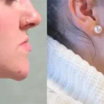 Casos clínicos ORTHOFACIAL