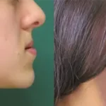 Casos clínicos ORTHOFACIAL