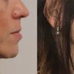 Casos clínicos