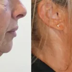 Casos clínicos ORTHOFACIAL