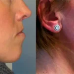 Casos clínicos ORTHOFACIAL