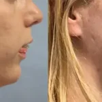 Casos clínicos ORTHOFACIAL