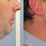 Casos clínicos ORTHOFACIAL