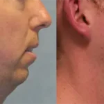 Casos clínicos ORTHOFACIAL