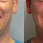 Casos clínicos ORTHOFACIAL