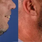Casos clínicos ORTHOFACIAL