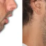 Casos clínicos