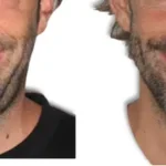 Casos clínicos ORTHOFACIAL