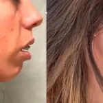 Casos clínicos ORTHOFACIAL