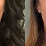 Casos clínicos ORTHOFACIAL