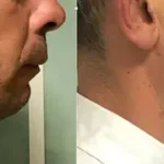 Casos clínicos ORTHOFACIAL
