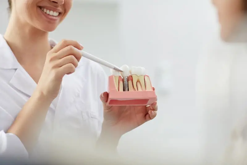 Implante dental en Bilbao