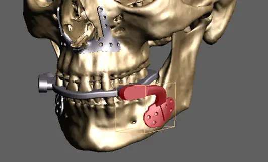 ORTHOFACIAL