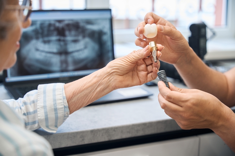 Cuidados después de un implante dental